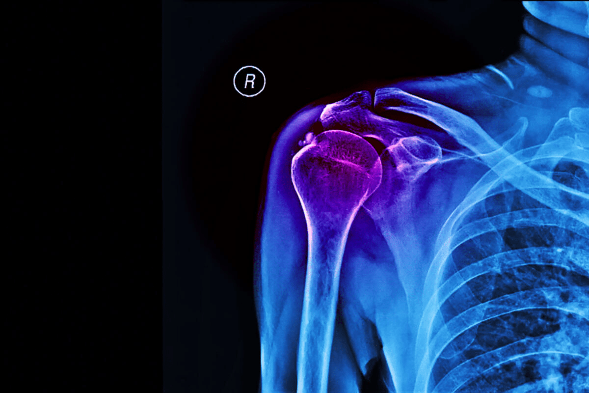 Valuable Rotator Cuff Exercises After Surgery: Full Guide 3 Valuable Rotator Cuff Exercises After Surgery: Full Guide