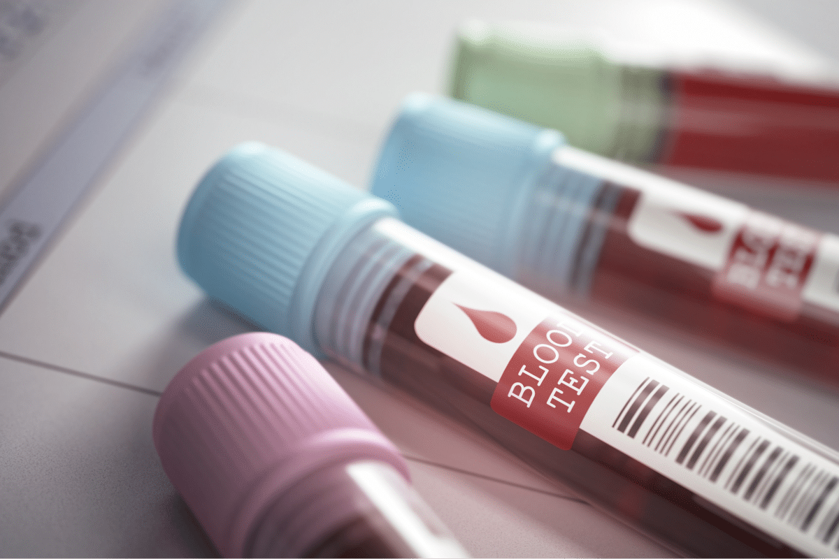 word image 239075 2 LIV Hospital