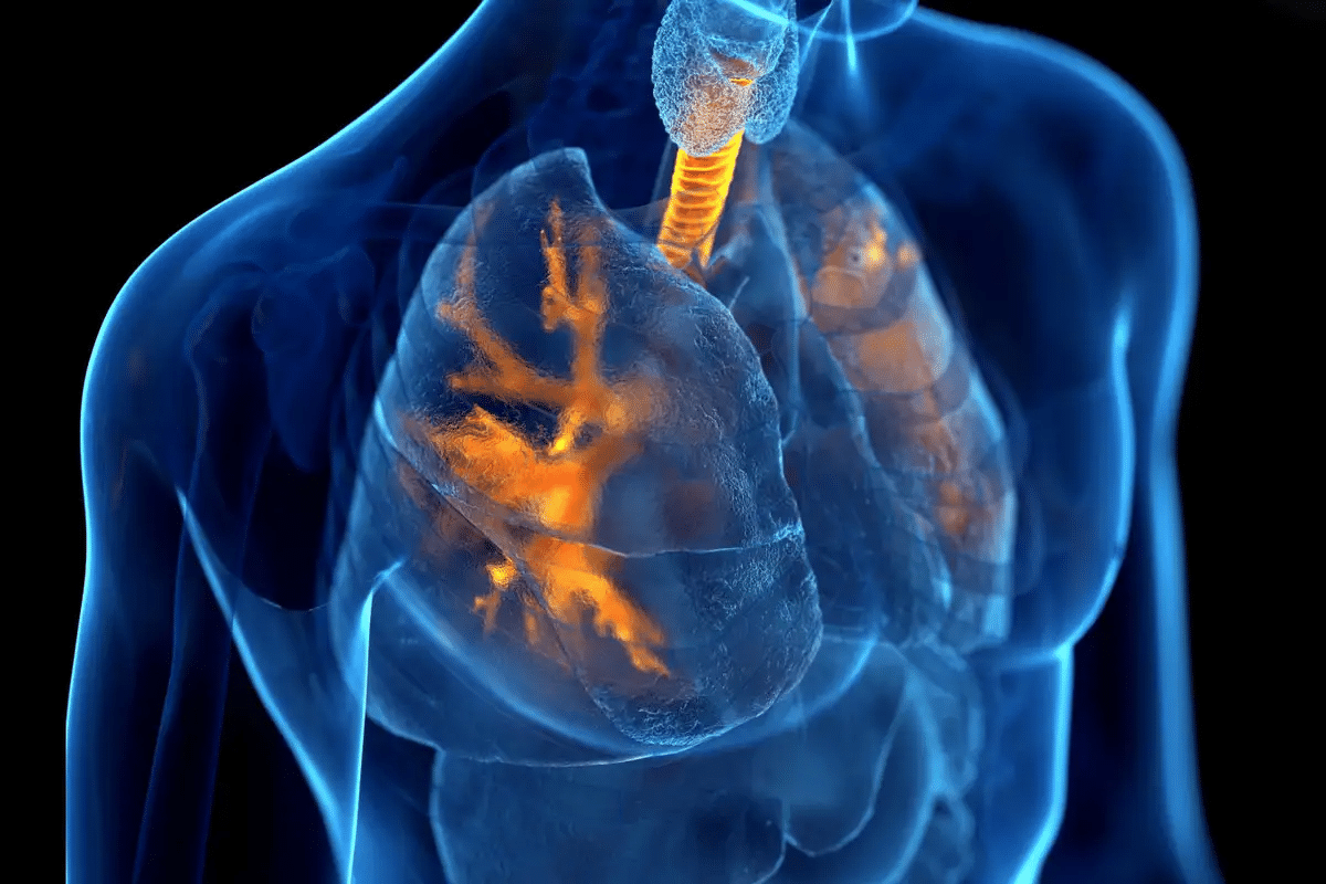 Simple Is Asthma Considered A COPD Disease Explained