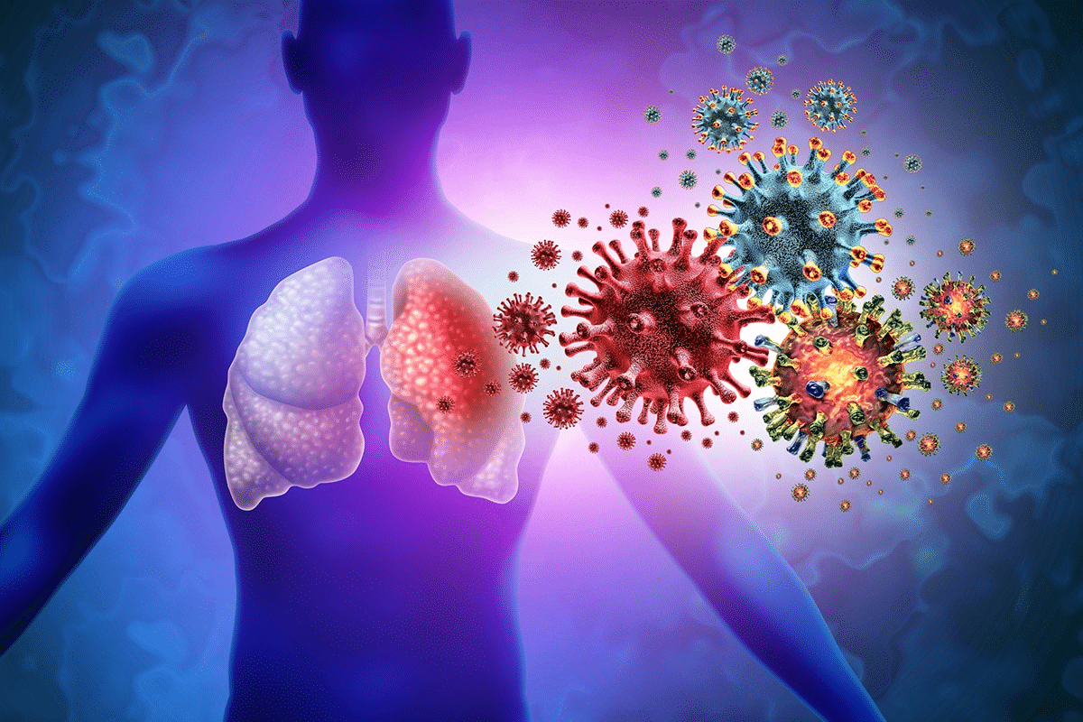 Bronchitis vs Flu: Critical Symptom Differences