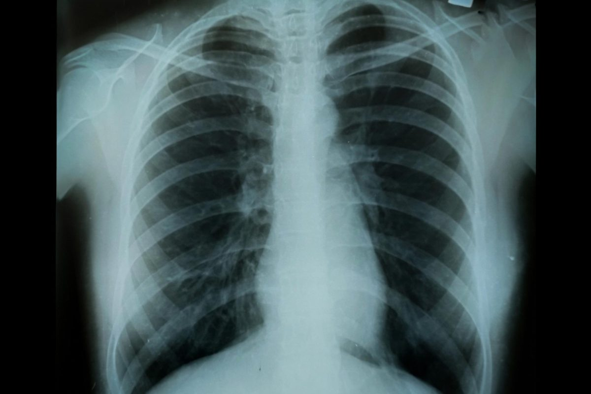 Ultimate 4 COPD Categories: GOLD Guide