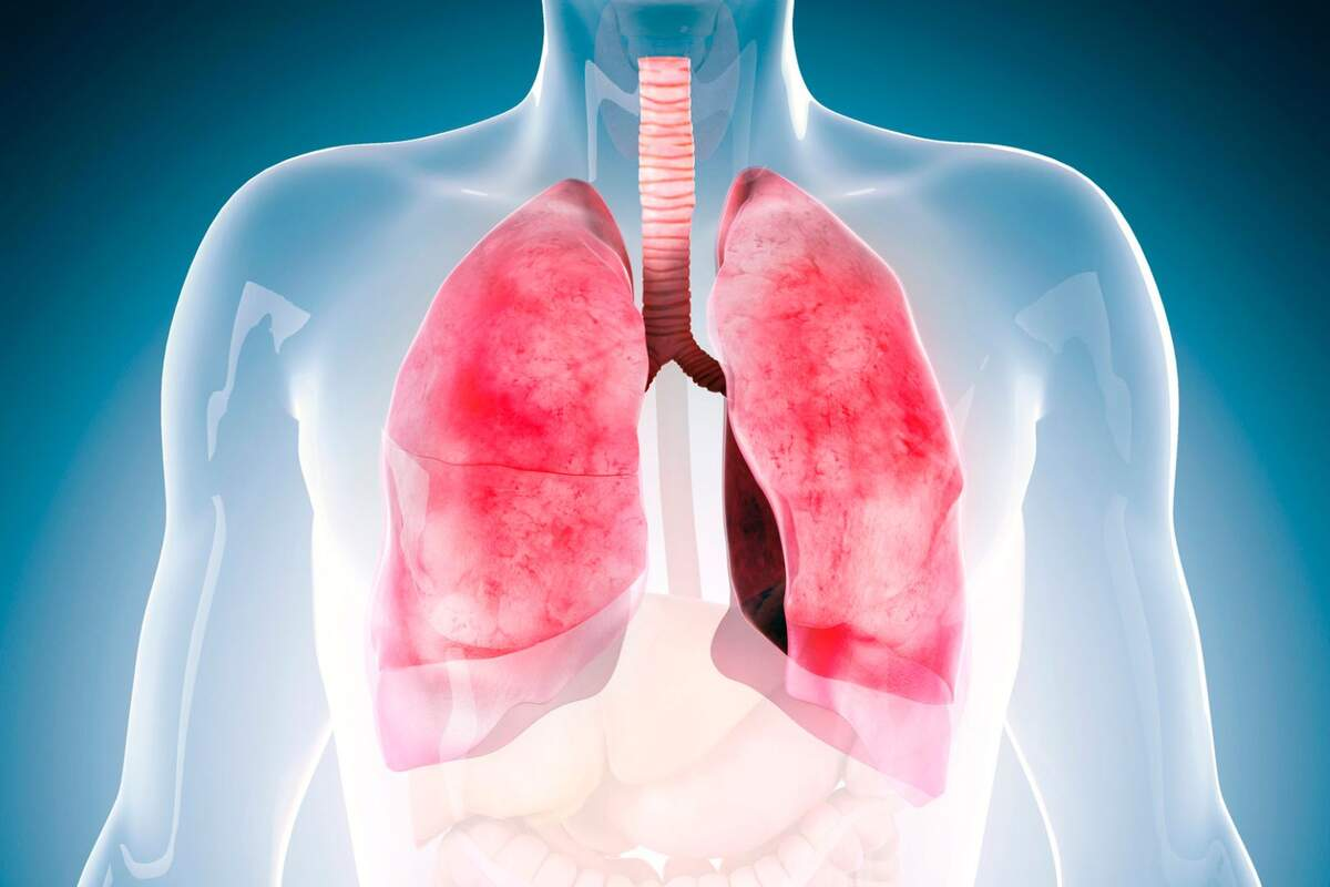 Average Lifespan of COPD Patient: Vital 3 Average Lifespan of COPD Patient: Vital
