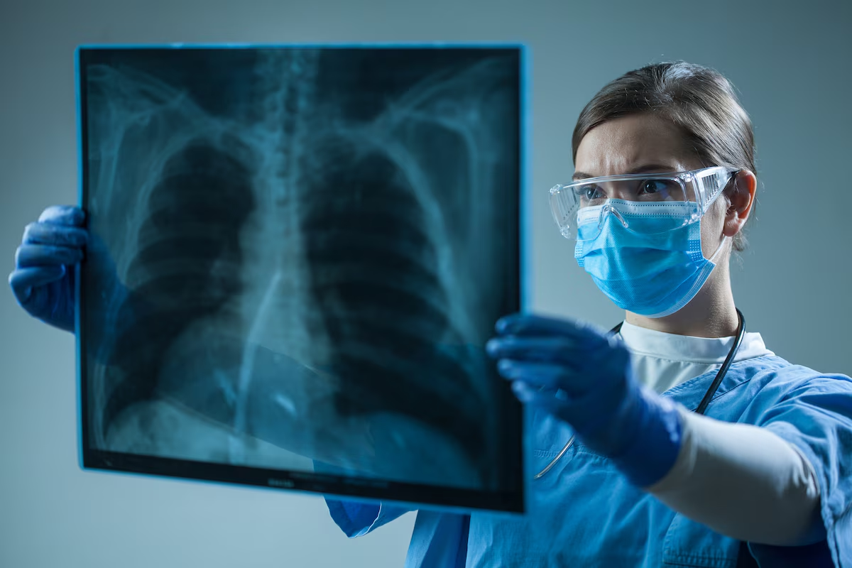 Insightful 7 Common Lung X Ray Abnormalities Visual Guide