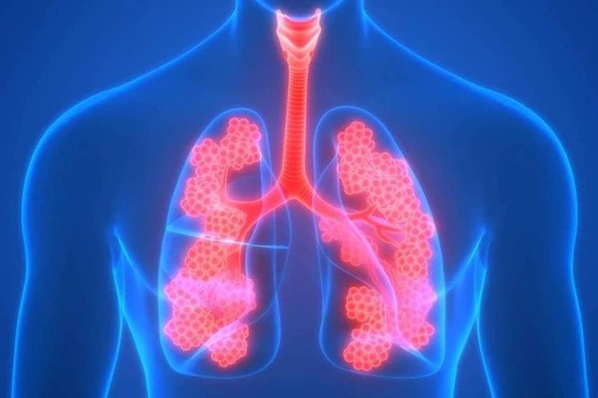 Lung Function Test for Asthma: Essential Guide