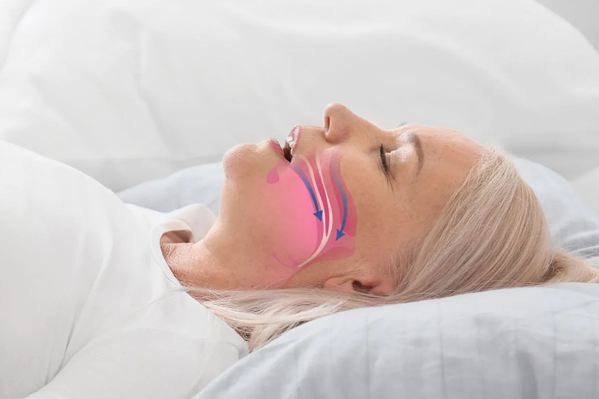 Essential Central Apnea Treatment: A Complete Guide