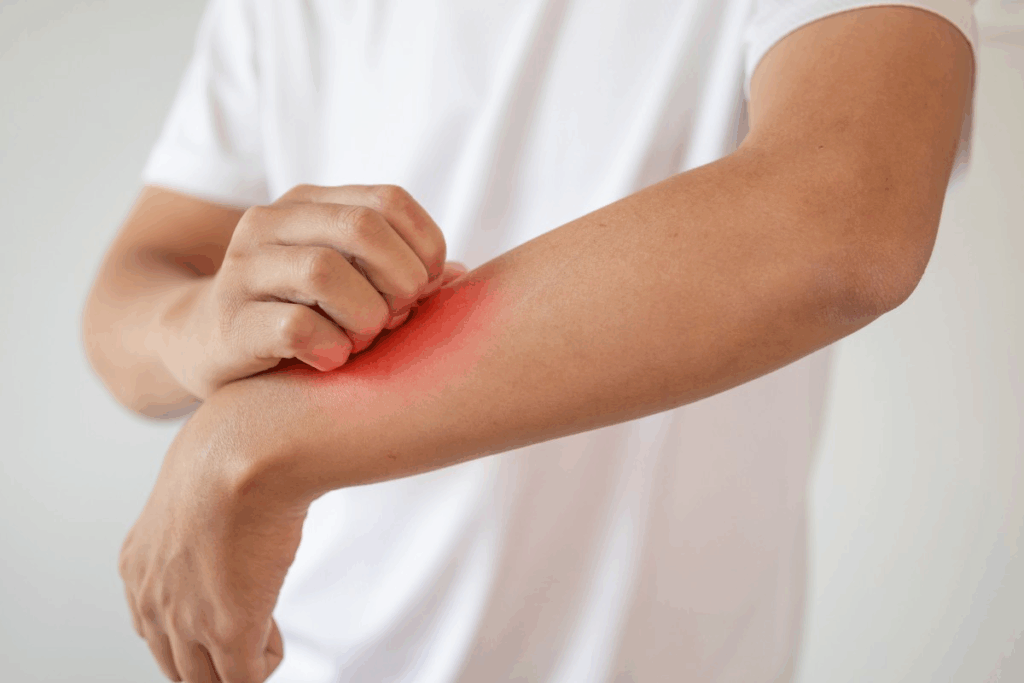 Can Benadryl Help With Itching? Vital Guide