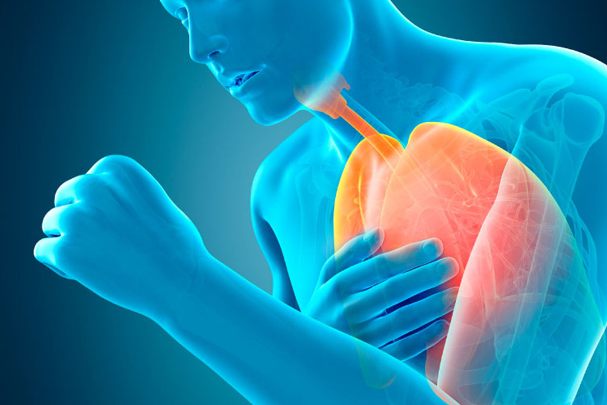 Treatment for Acute COPD: Best Guide