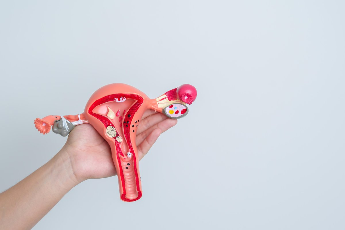 Simple How To Treat Prolapsed Uterus: Signs & Solutions