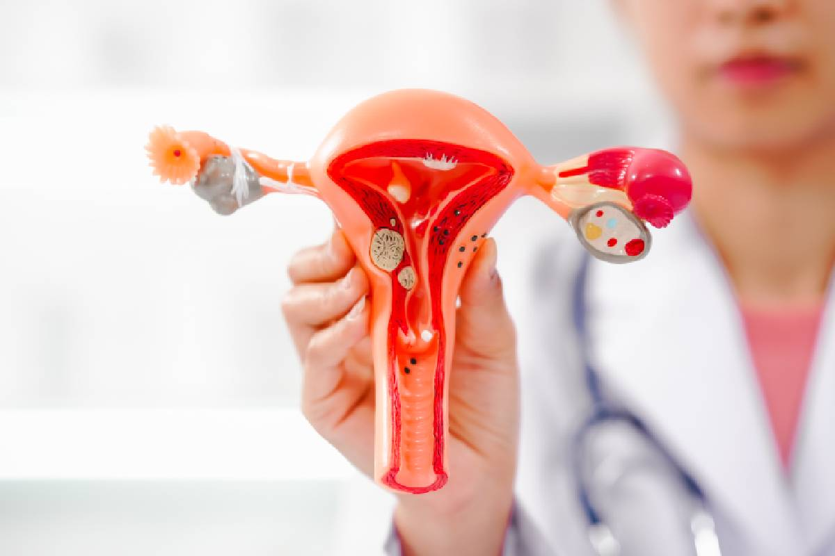 Amazing Can You Push A Uterine Prolapse Back Up: Options