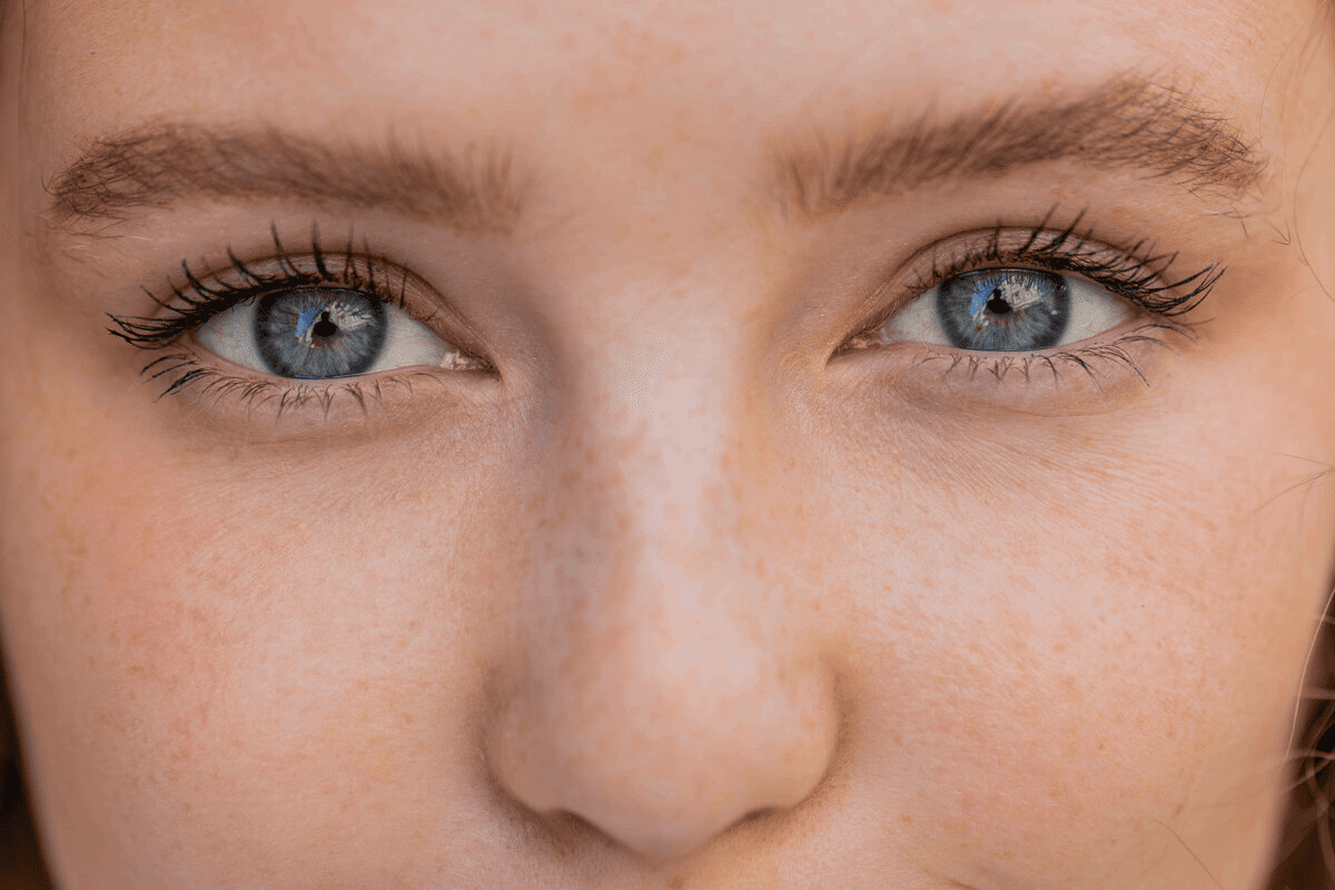 ARMD drusen: The Ultimate Guide to AMD