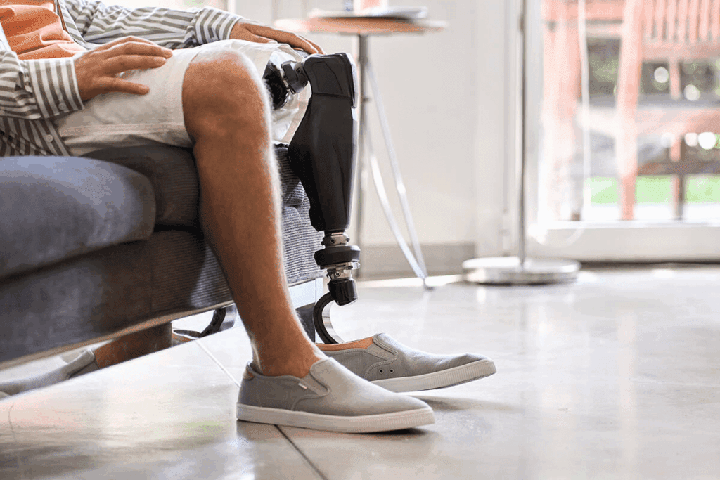 Amazing 5 Types Of BKA Prosthetic Leg Options