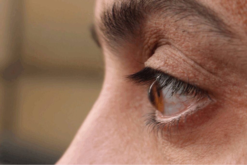 ERM retina: An Essential Guide to Macular Pucker