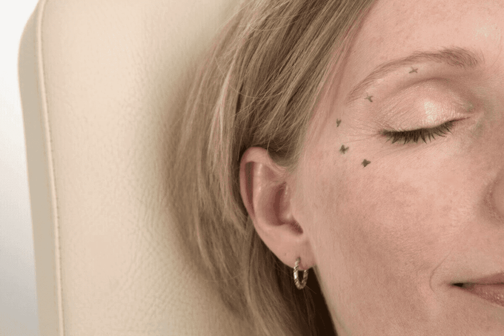 Double eyelids surgery: Your Ultimate Guide