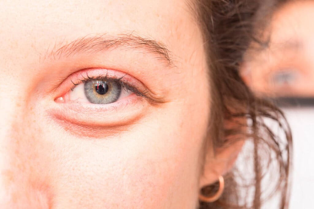Essential 7 Eye eye Disease That Causes Blindness: What To Know