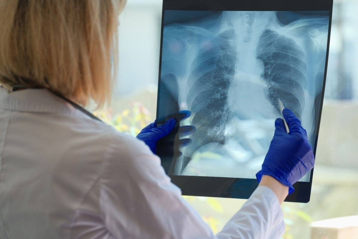 image 1763549897532 LIV Hospital