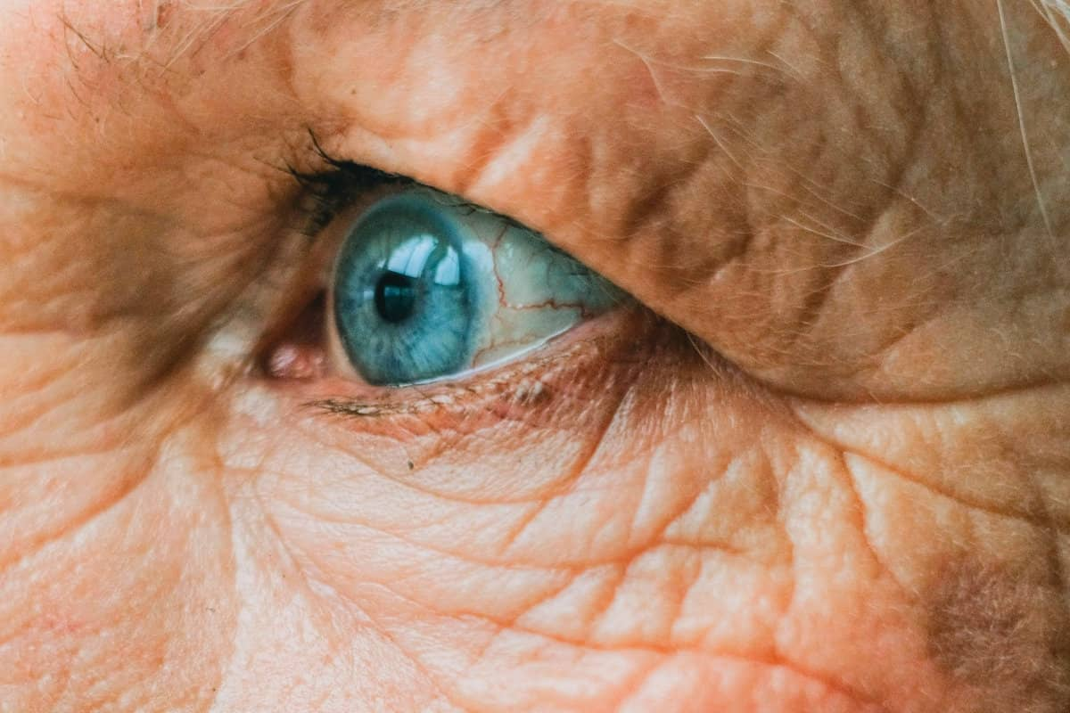 Diabetes and yellow eyes: What's the Link?