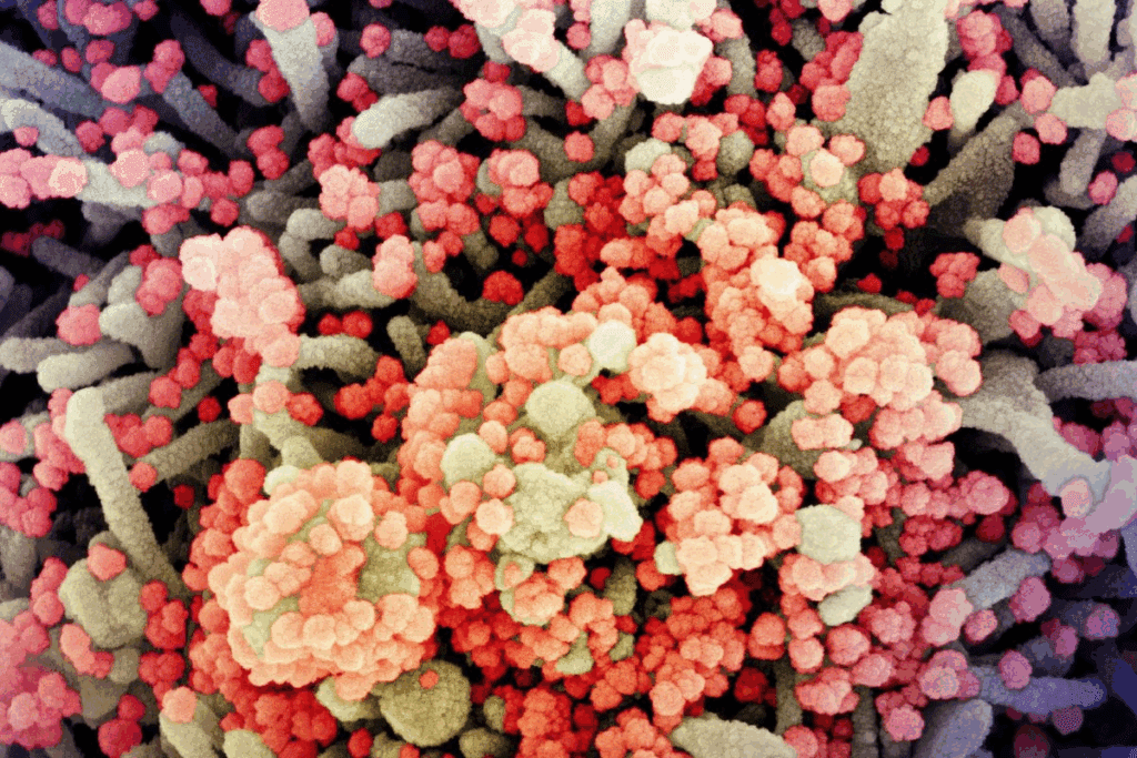 Key Who Performs Eyelid Surgery Bags Blepharoplasty?