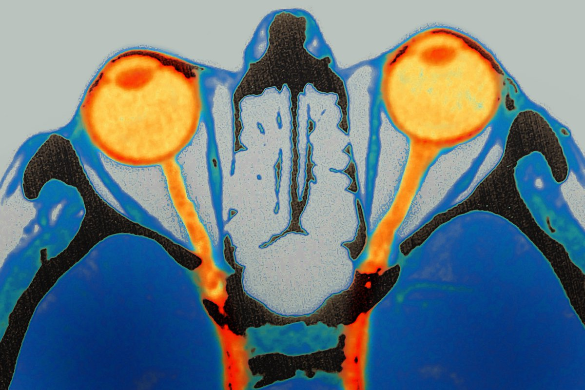 How to Remember Cranial Nerves in Order: Easy Mnemonics