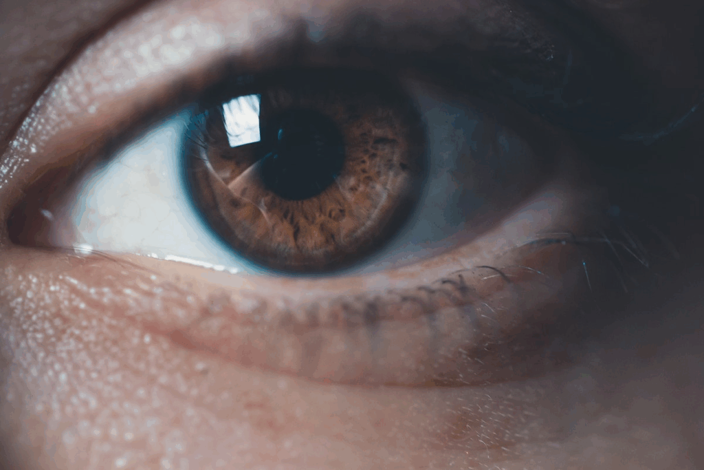 Epiretinal membrane on OCT: 5 Key Findings