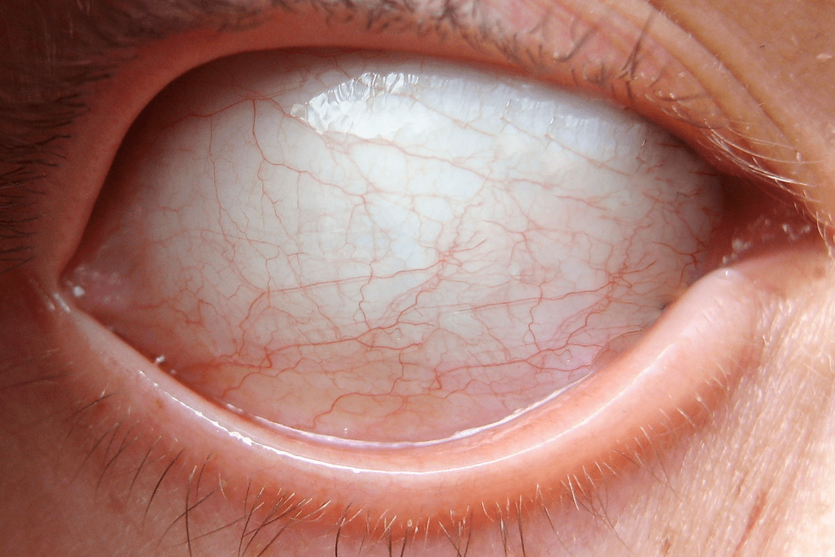 What Causes Intermittent Blurry Vision? 7 Alarms