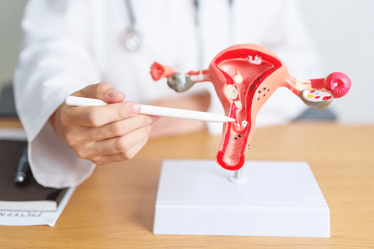 How Do I Know If I Have Endometriosis? Alarming Signs