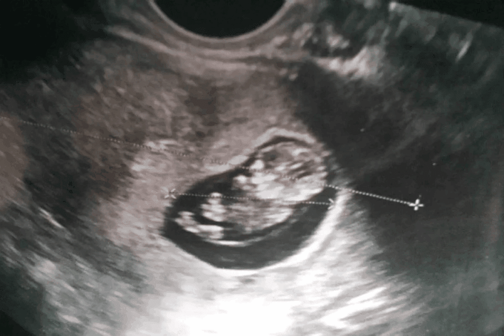 Fetal Abdominal Circumference: Critical Guide 1 Fetal Abdominal Circumference: Critical Guide