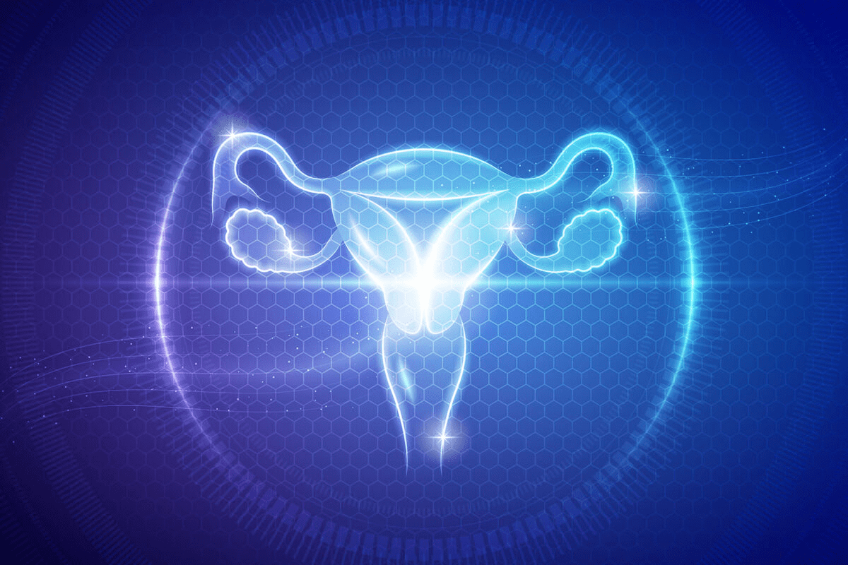 Endometriosis Back Pain: The Ultimate Relief Guide