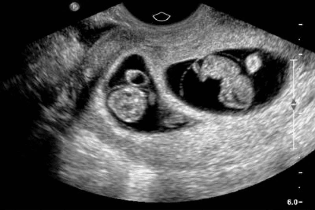 What Does an 8 Week Fetus Look Like? 1 What Does an 8 Week Fetus Look Like?