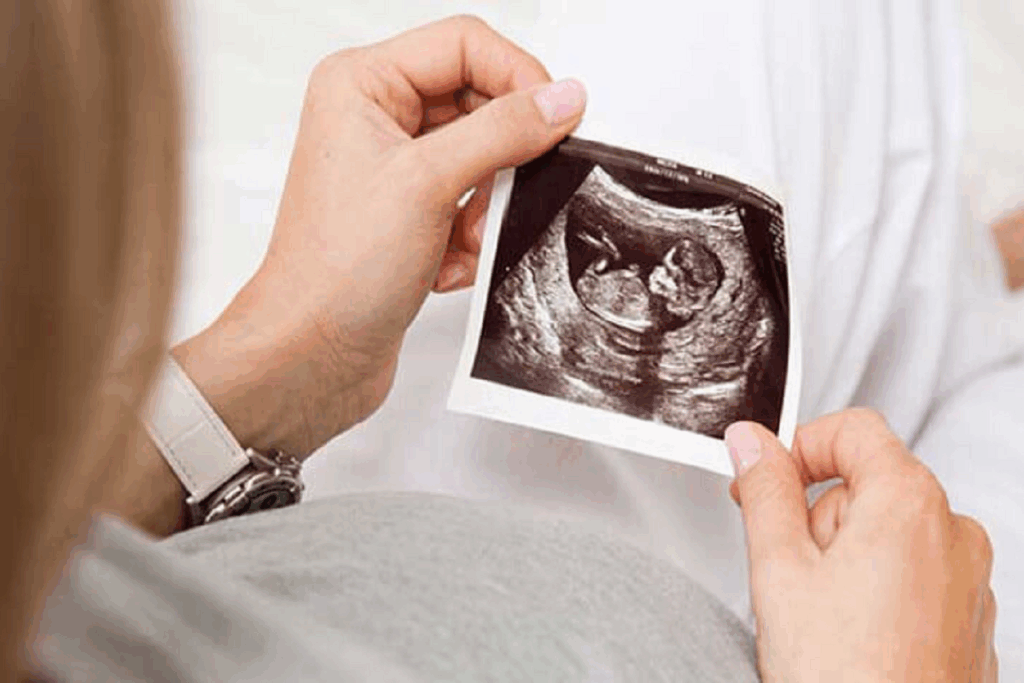 When Can You Hear Baby Heartbeat on Ultrasound