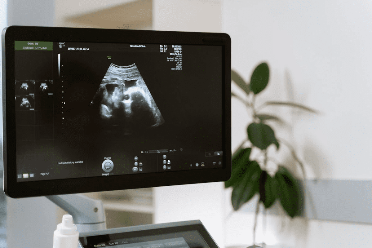 Sharp 3D & 4D Ultrasound: 8 Week Ultrasound 3D Guide