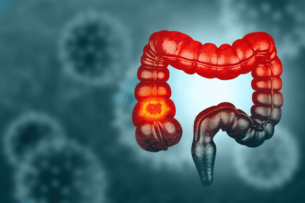 Stomach Acid Burning Throat: 5 Best, Proven Fixes