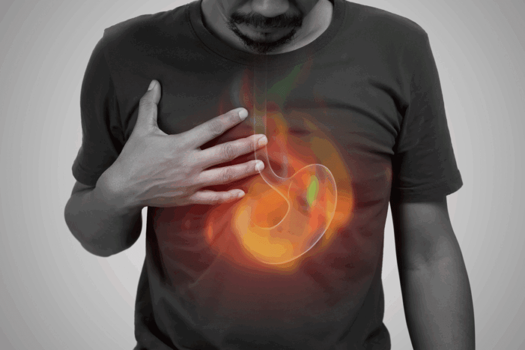 Best Over the Counter Treatment for Heartburn: 5 Picks