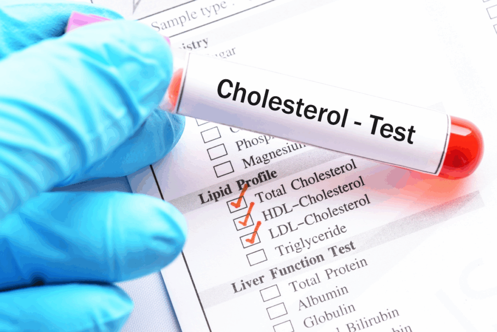 7 Hyperlipidemia Meds to Lower Cholesterol Fast