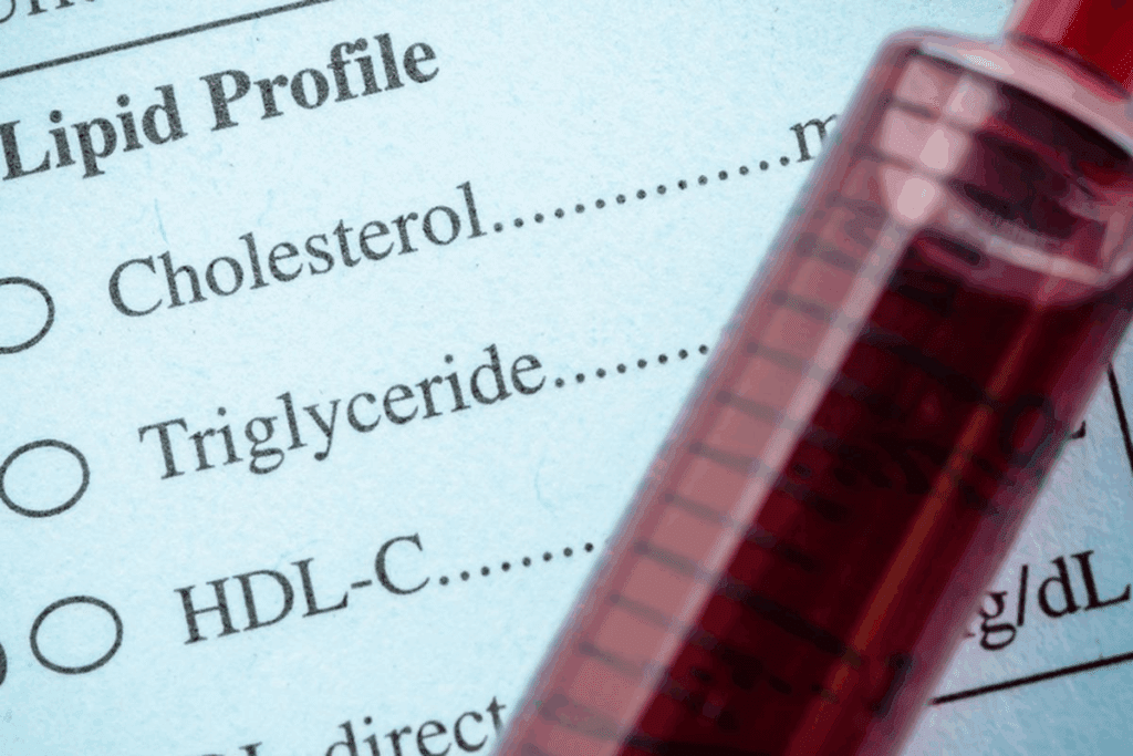 7 Hyperlipidemia Meds to Lower Cholesterol Fast