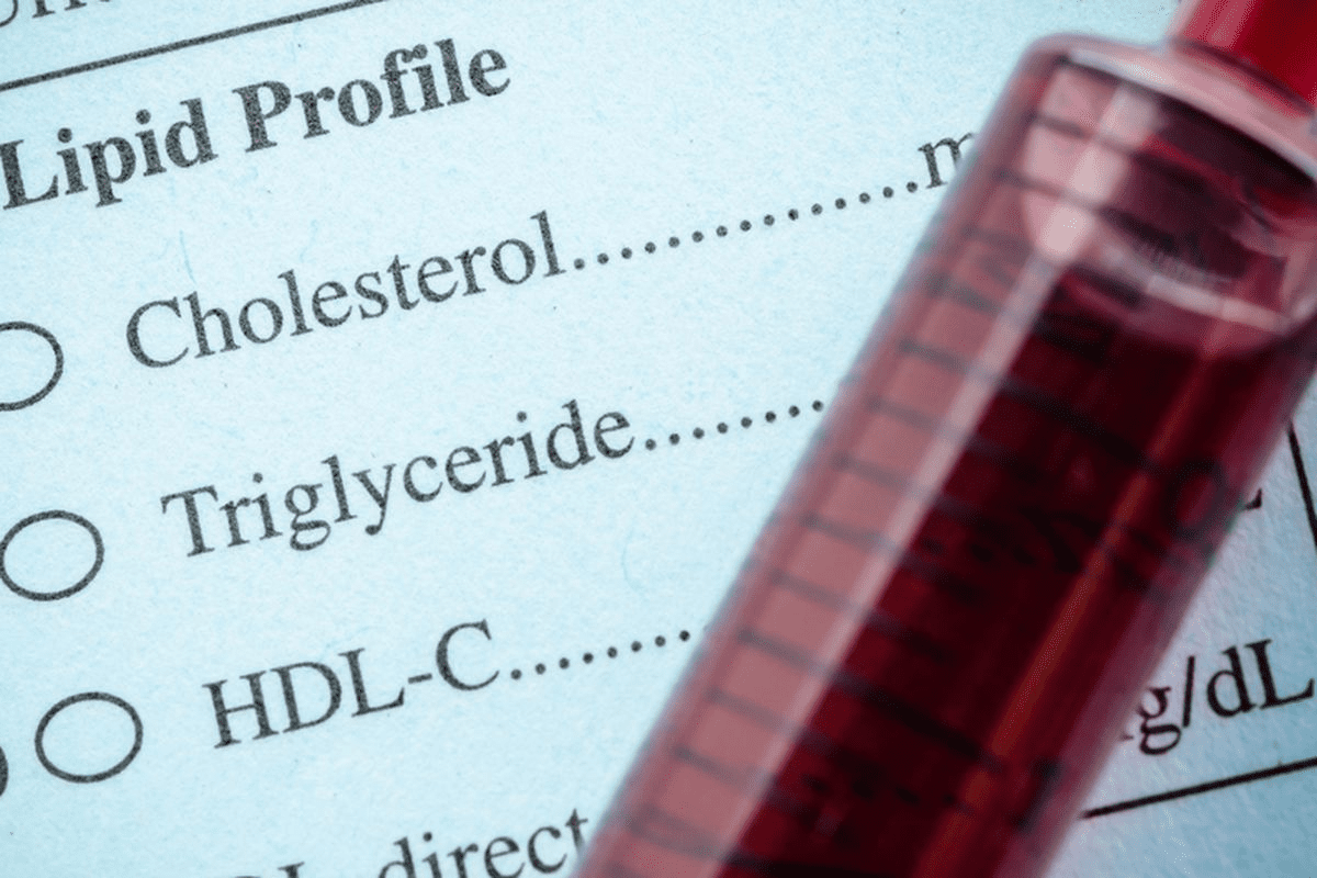 7 Hyperlipidemia Meds to Lower Cholesterol Fast