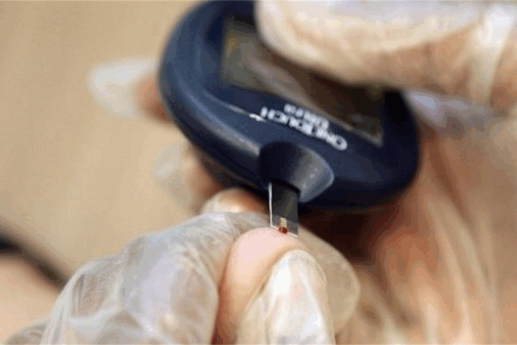 Define: Can You Get Both Types Of Diabetes?