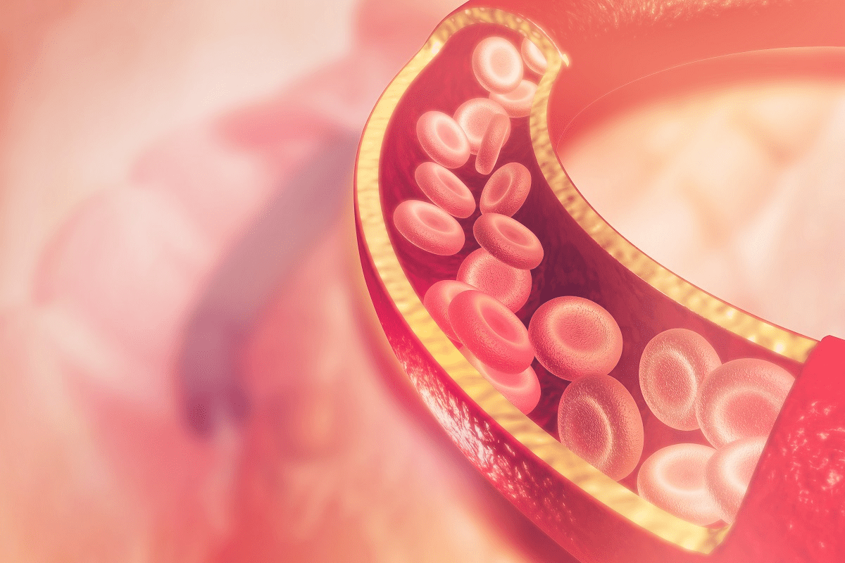 Define: Does Stress Increase Cholesterol?