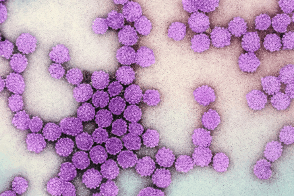 HPV on Lips: 5 Alarming Signs & Symptoms