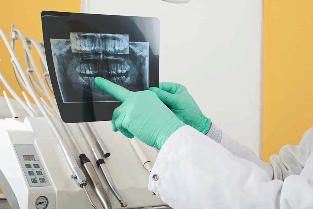 Dental Radiographs: Your Ultimate Guide (5 Key Facts)