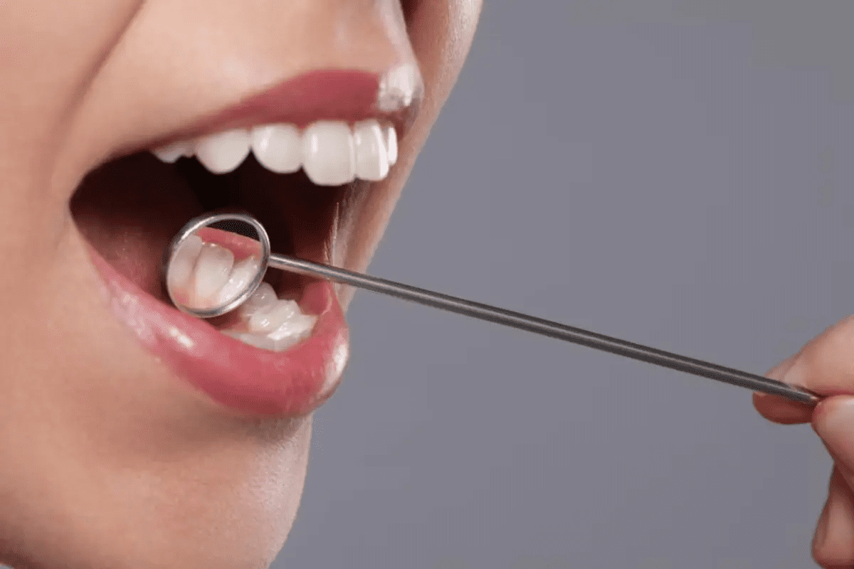 Scar Tissue on Tongue: Your Ultimate Guide