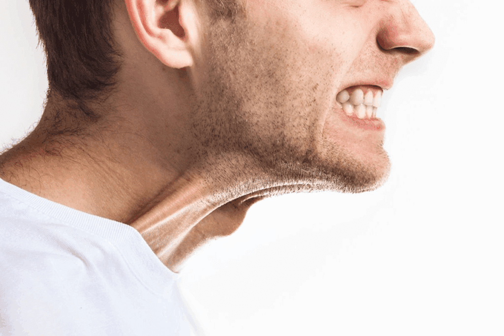 How To Cure TMJ: Is Tmj Permanent? 1 How To Cure TMJ: Is Tmj Permanent?