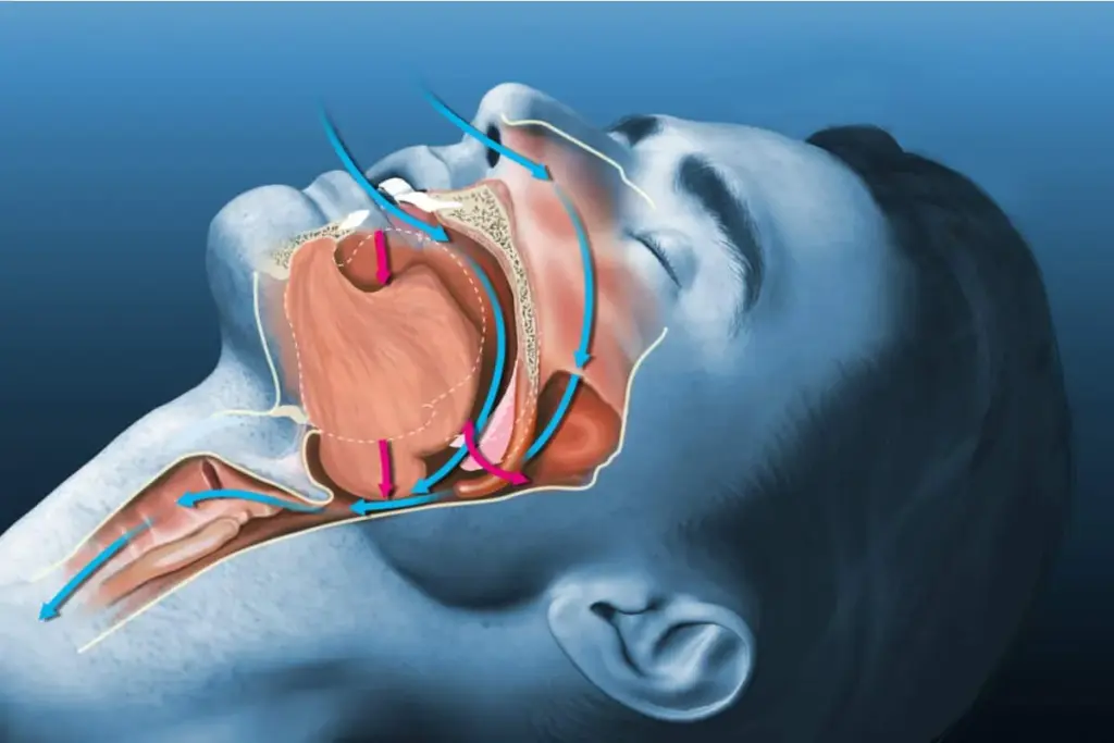 Home Sleep Apnea Test: Easy Proven Guide.