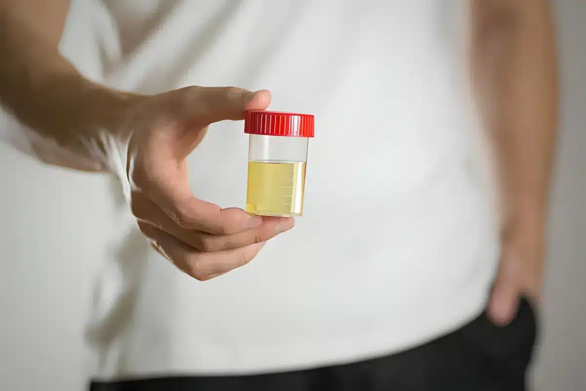 Prostate Biopsy Bleeding: How Long Does It Last?