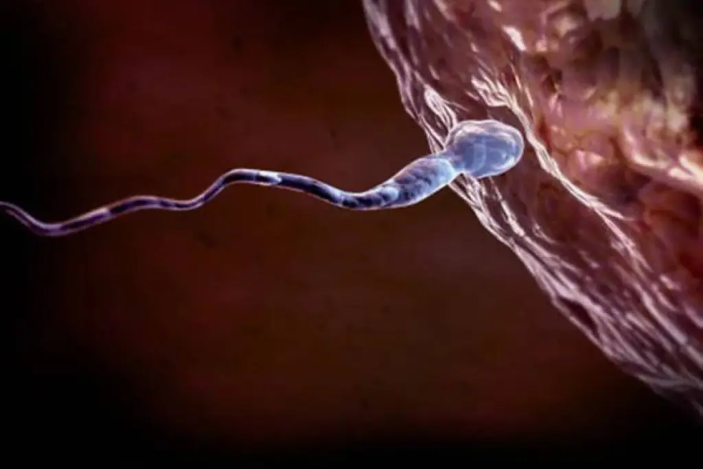 Morphology Secrets: Infertile Sperm Look 3 Morphology Secrets: Infertile Sperm Look