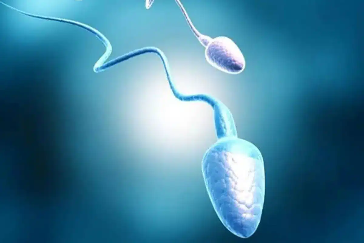 Morphology Secrets: Infertile Sperm Look