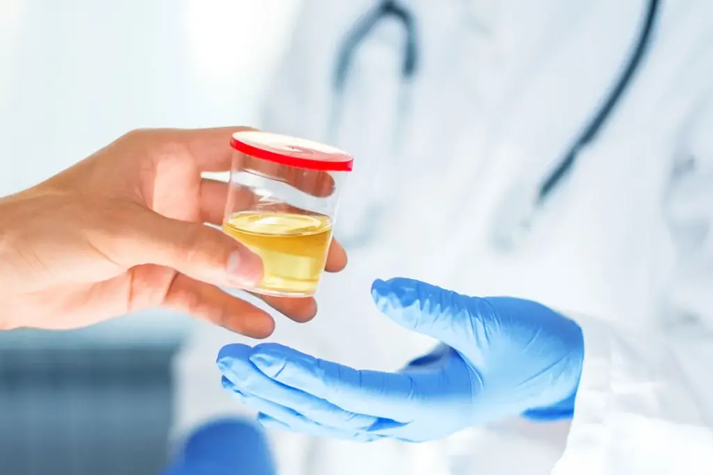 What Can Be Detected In A Urine Test Info 2 What Can Be Detected In A Urine Test Info