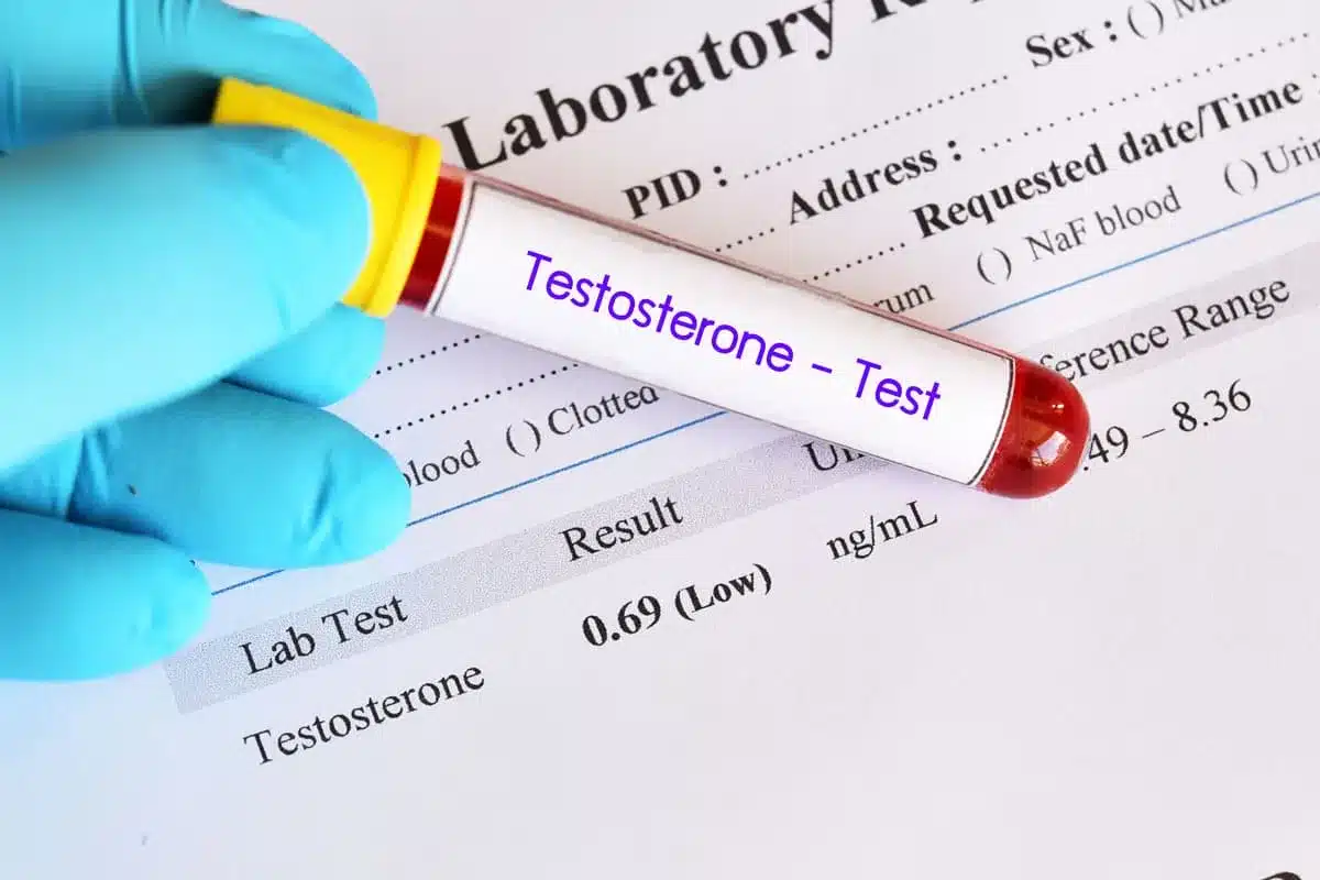 Testosterone Signs: Best Low T Symptoms