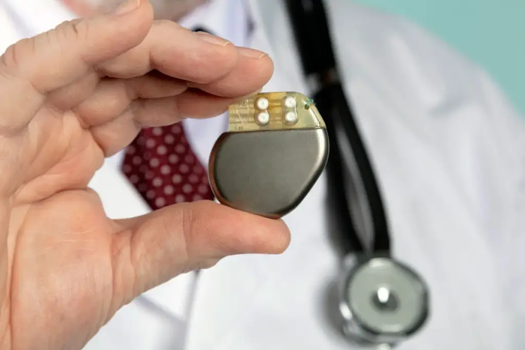 Side Effects Of Pacemaker Long-Term: 4 Risks