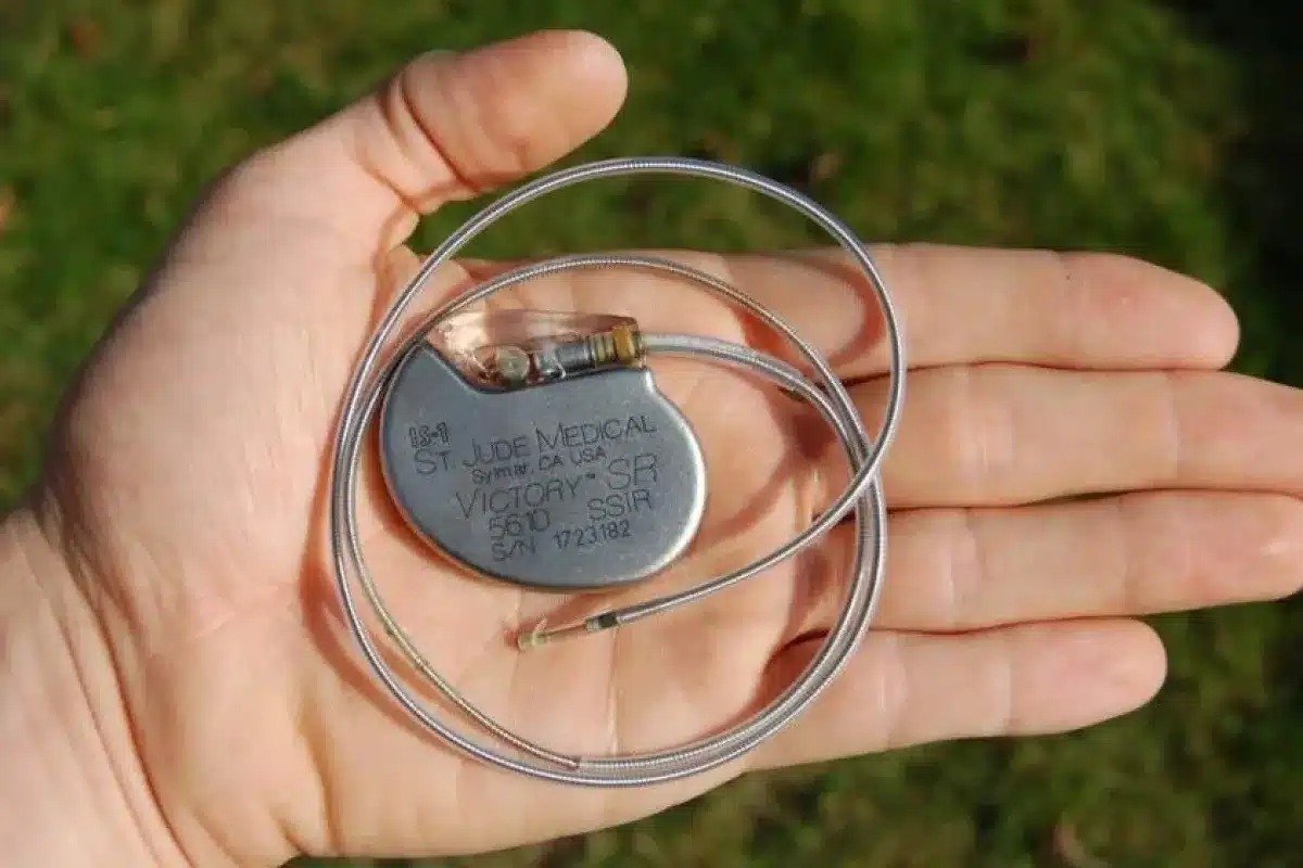 Defibrillator Definition: Best Vital Uses