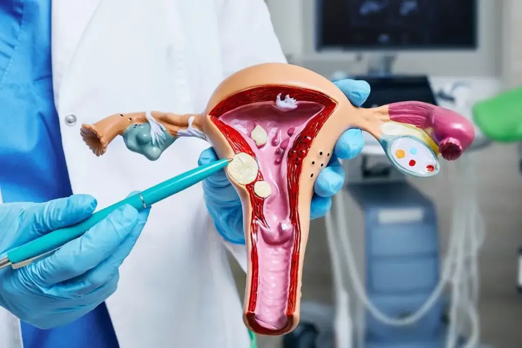Crucial How Long Does A Uterine Embolization Take (Uterine Embolization Duration)?